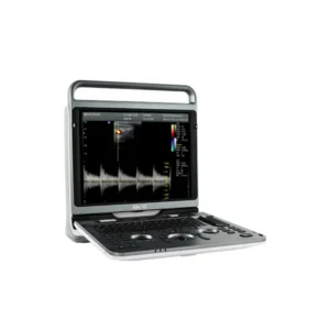 Pantalla del ultrasonido Chison EBit 50 mostrando imágenes ecográficas en alta definición