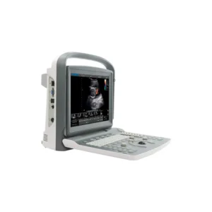 Ultrasonido Chison ECO2 con transductor convexo conectado