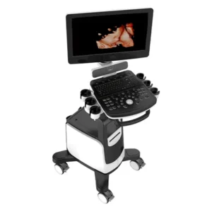 Ultrasonido Chison Qbit 7 con transductor lineal conectado en escaneo vascular