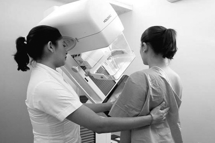 El mastógrafo y la detección del cáncer de mama