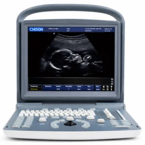 Ultrasonido Portátil de Alta Precisión ECO 2+