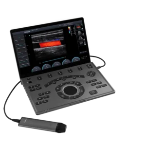 Ultrasonido Portátil Sonoair-30