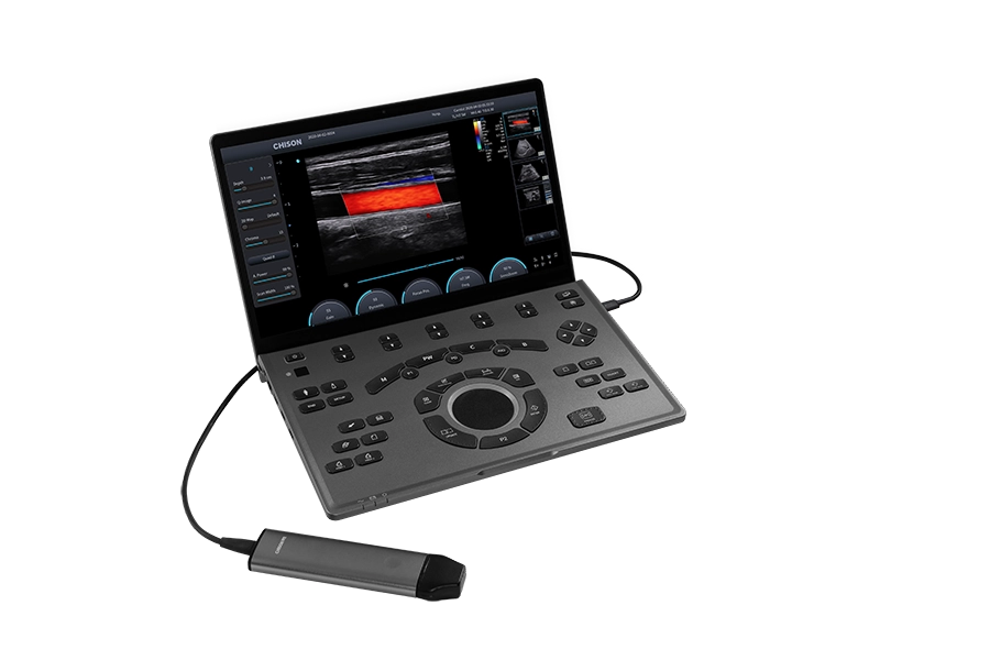 Ultrasonido Portátil Sonoair-30