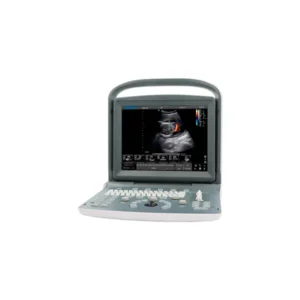 Vista frontal del ultrasonido Chison ECO2 mostrando interfaz en pantalla